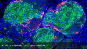 Evotec expands its Sanofi alliance with new 330m diabetes drug development (outsourcing-pharma.com)