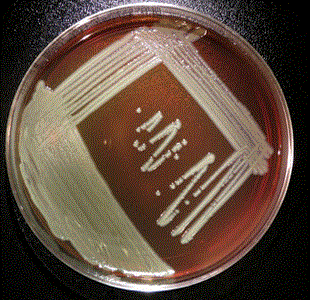 Illinois says five more people with bacterial infection have died (reuters.com)