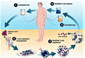 The First CAR-T Drugs Have Left the Gate (fool.com)