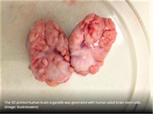 3D printed brain helps characterize 11 lead compounds, neuropathological research (outsourcing-pharma.com)