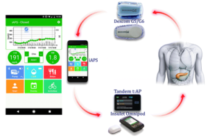 Experimental phone app works with insulin pumps to control diabetes (reuters.com)