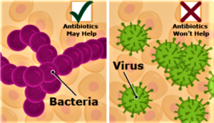 ‘Nudging’ Antimicrobial Use in the Right Direction (pharmacypracticenews.com)